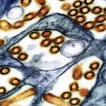 New Pandemic On The Horizon?